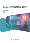 临床心电图图谱精选及解析