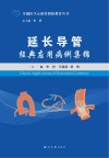 延长导管经典应用病例集锦