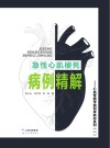 急性心肌梗死病例精解