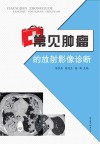 常见肿瘤的放射影像诊断封面