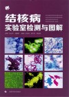 结核病实验室检测与图解封面