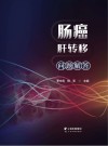 肠癌肝转移问题解答封面