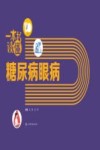 一本书读懂糖尿病眼病